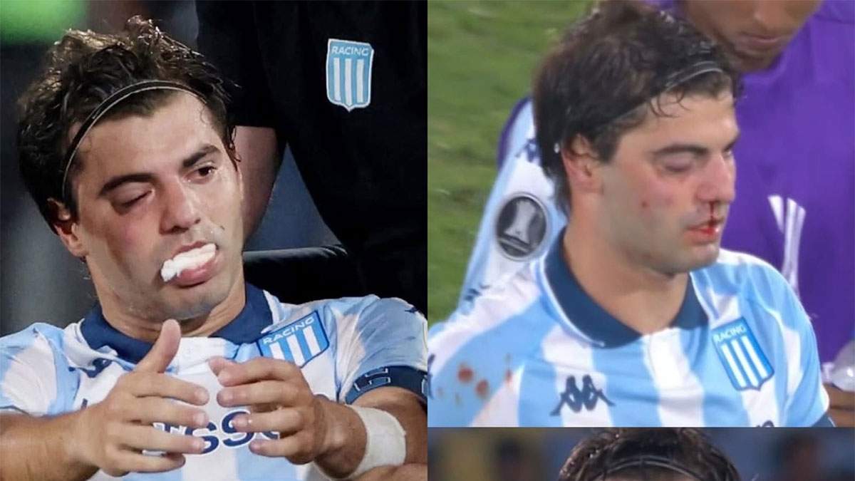 Así se ve un futbolista cuando se encuentra con Rojo... ¡pobre Santi Sosa!
