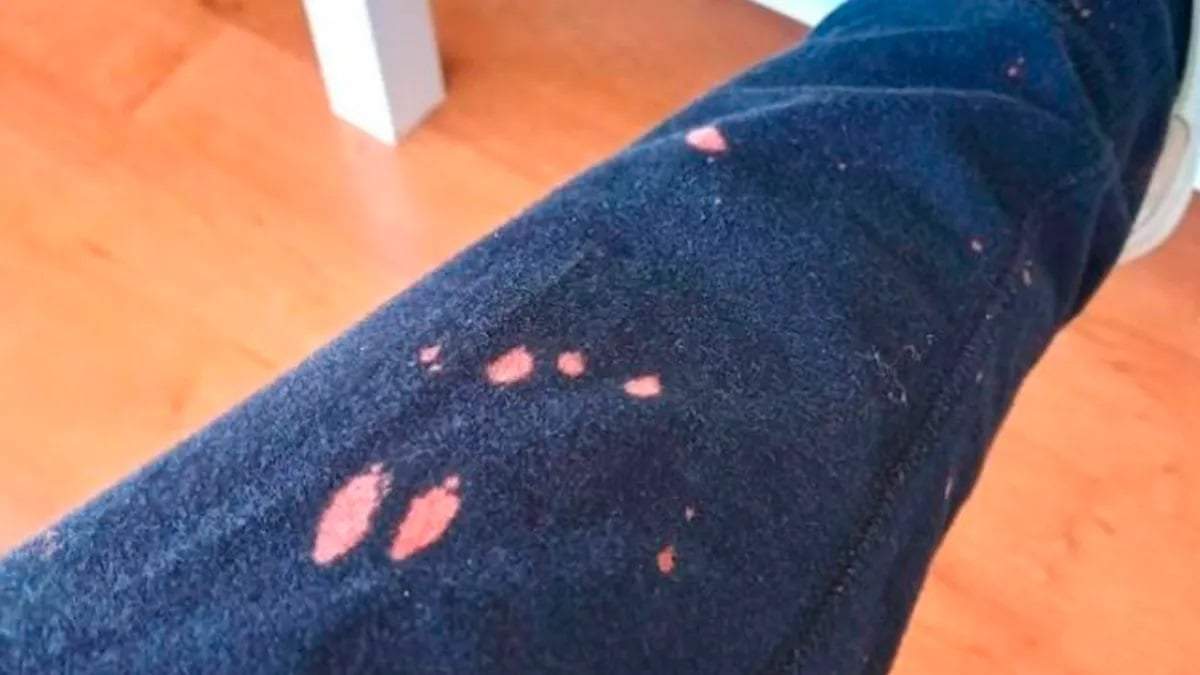 Manchas de lavandina. Fuente: (X)