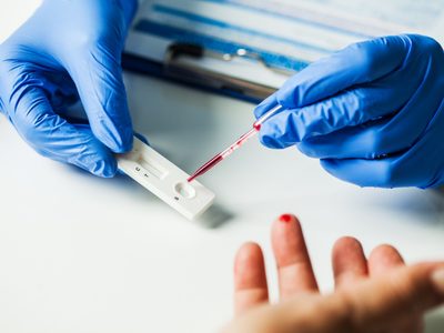 La inmunidad contra el coronavirus “decae rápidamente”, según estudio del Imperial College