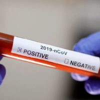 Alerta: una localidad neuquina confirmó su primer caso de coronavirus