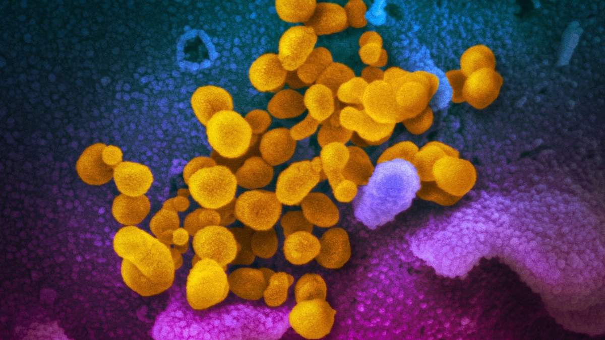 Coronavirus SARS-CoV-2, en amarillo