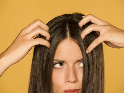 No gastes tu sueldo en productos carísimos: prepará el mejor remedio para tratar la caspa y fortalecer tu cabello