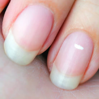 Nail Art: trucos infalibles para eliminar las manchas blancas que te salen en las uñas
