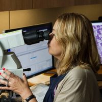 Inteligencia artificial podría diagnosticar cáncer de pulmón un año antes de métodos actuales