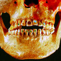 Revelaron por qué los mayas incrustaban piedras preciosas en sus dientes: no era solo por estética